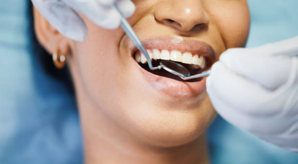 Best Emergency Treatment for Oral Infections in Indianola, MS